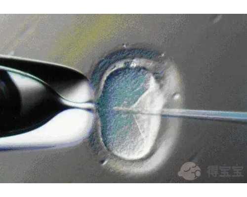 供卵试管可以选择性别，首先必须满足这几个条件！